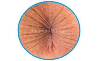Hémorroïdes : une bonne hygiène anale et rectale de l’anus